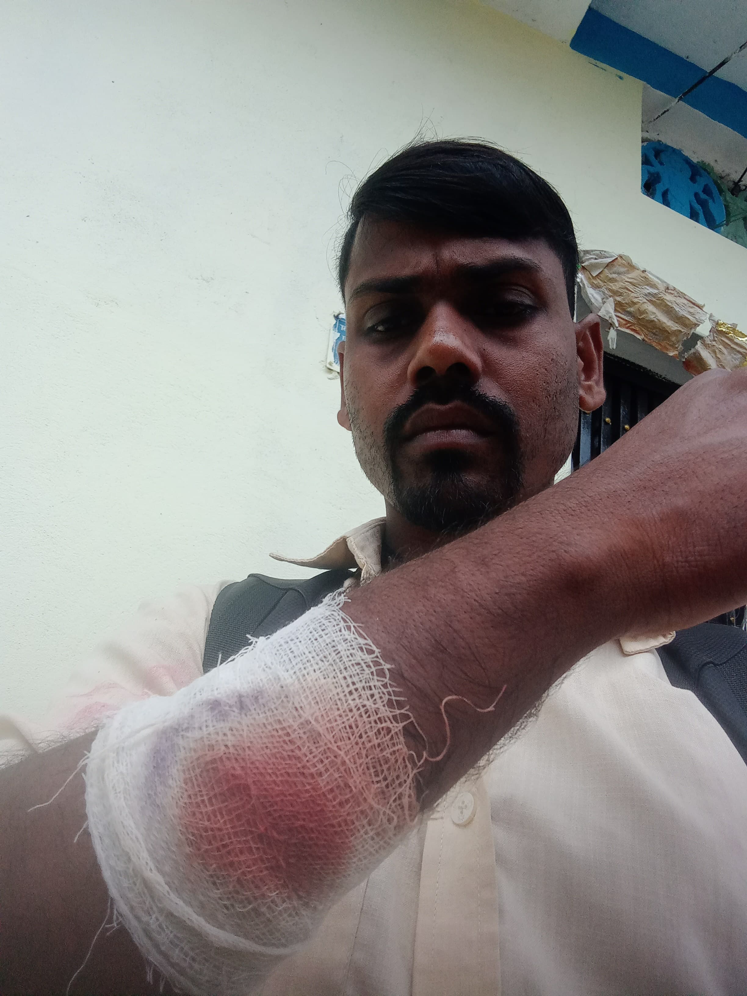 बाँके खडैचामा मदक पदार्थ सेवन गरि शसस्त्र प्रहरीद्धारा दुई स्थानीयलाई कुटपिट