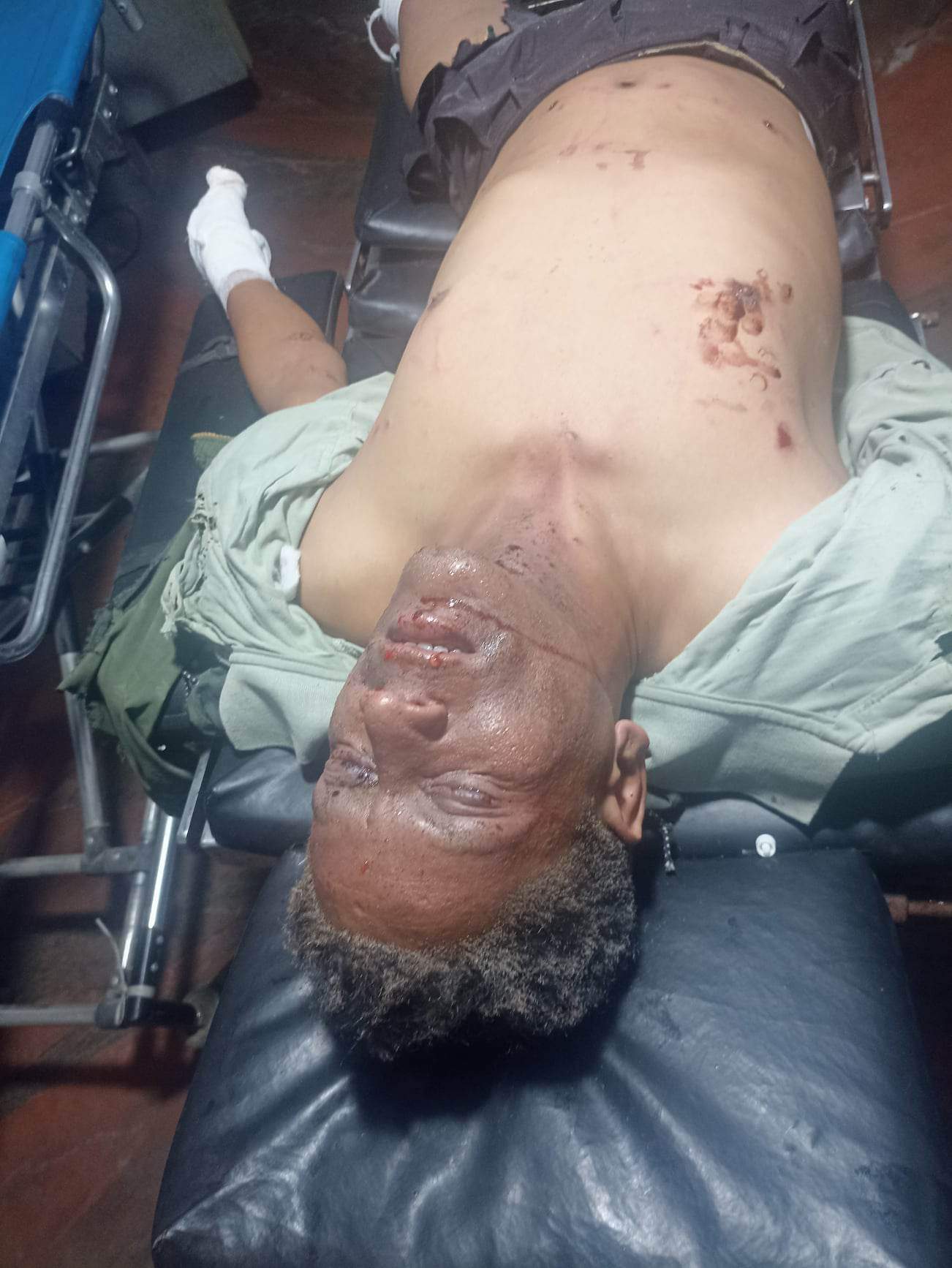 नेपालगन्जमा विष्फोट, दुई जना घाइते