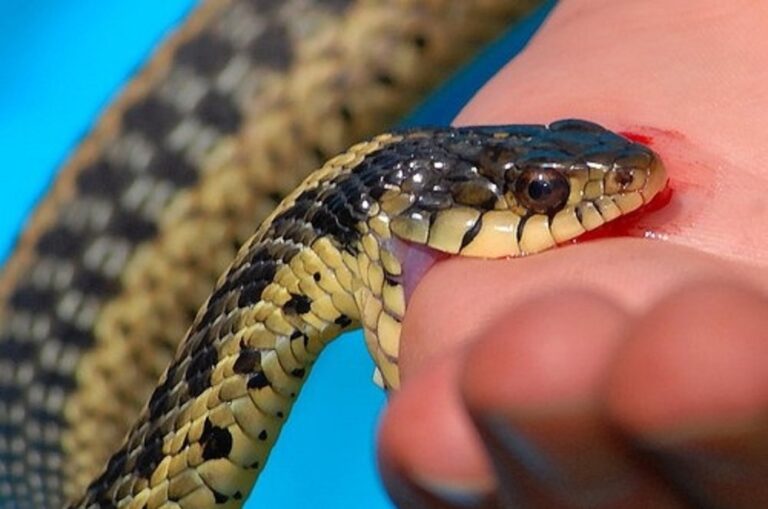 समयमै अस्पताल नपुग्दा ज्यान गुमाउँदै सर्पदंशका बिरामी