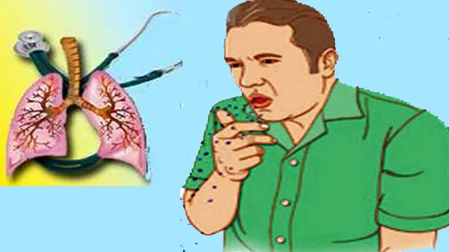 उपचारको पहुँचबाट बाहिरै छन् क्षयरोगी