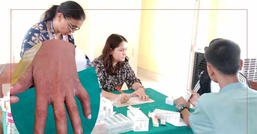 बाल सुधार गृहमा रहेका बालबन्दीमा छाला रोगको सङ्क्रमण